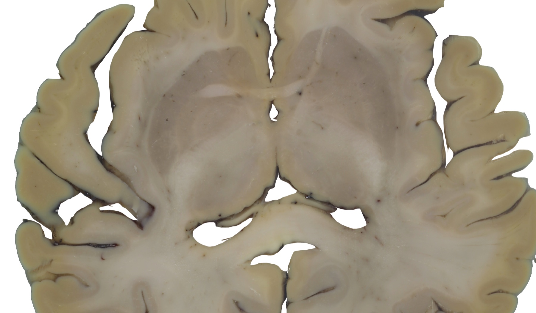 Blockface image of the SWAN specimen