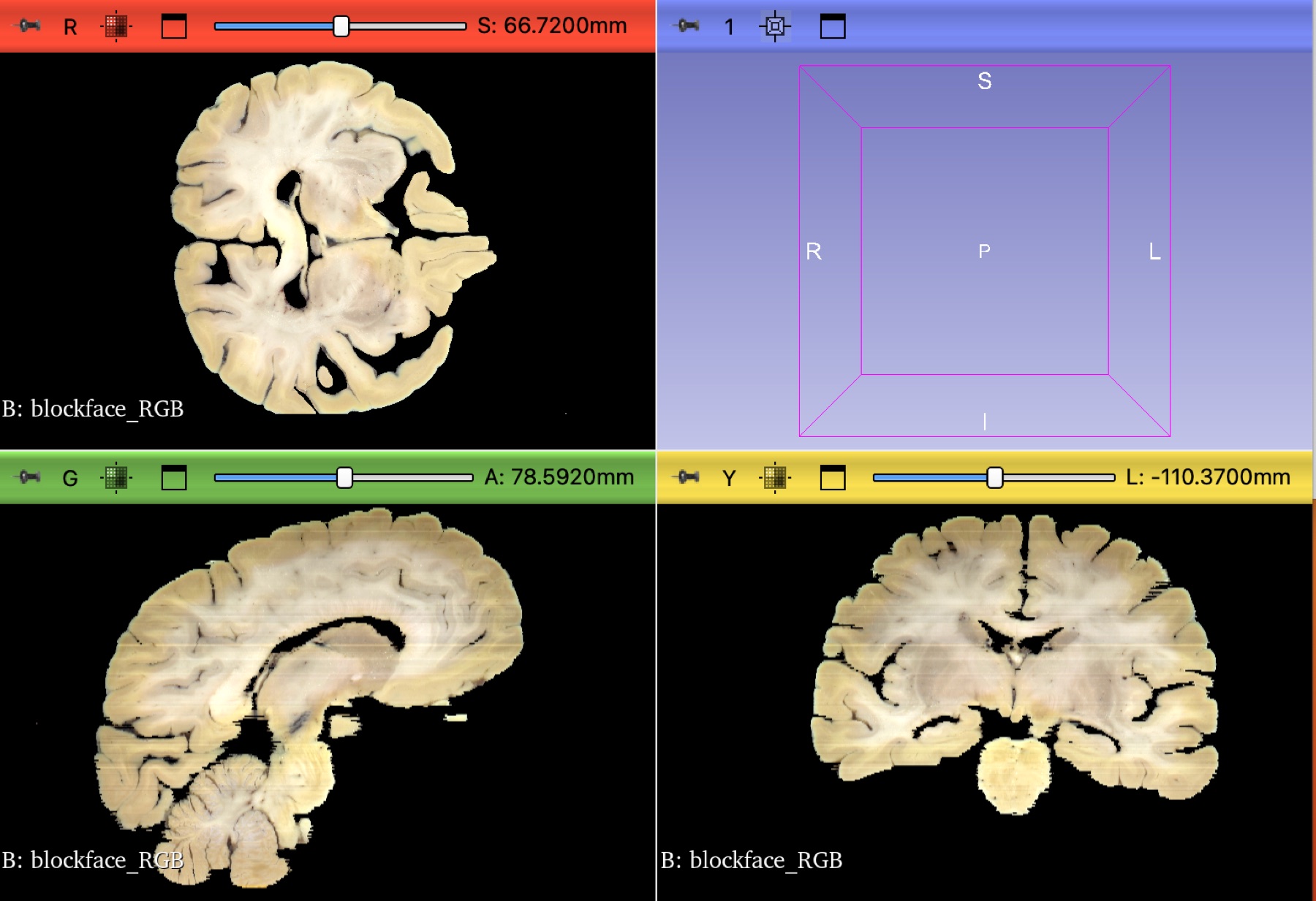 Three-dimensional blockface visualization in orthogonal views