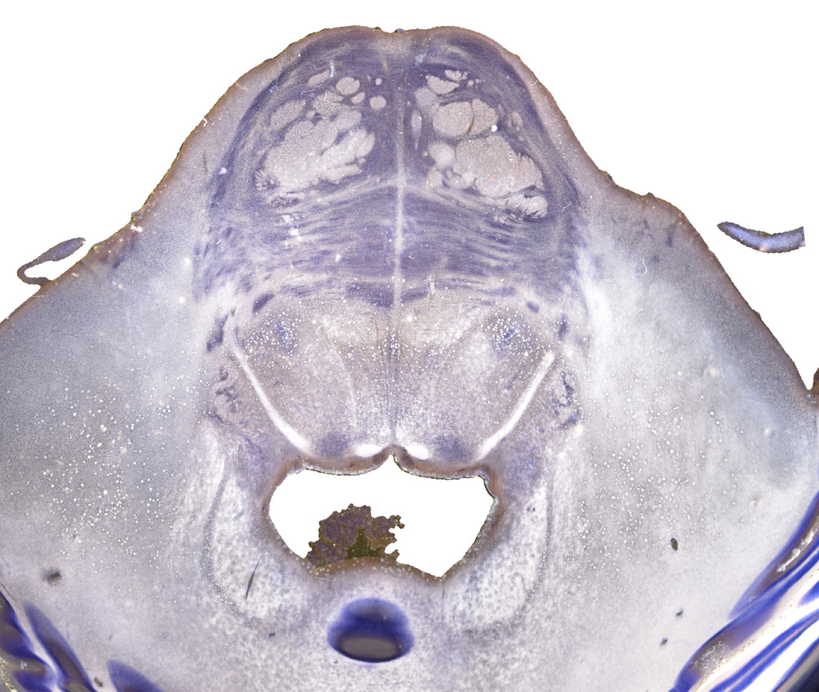 Darkfield microscopy image from the SWAN project