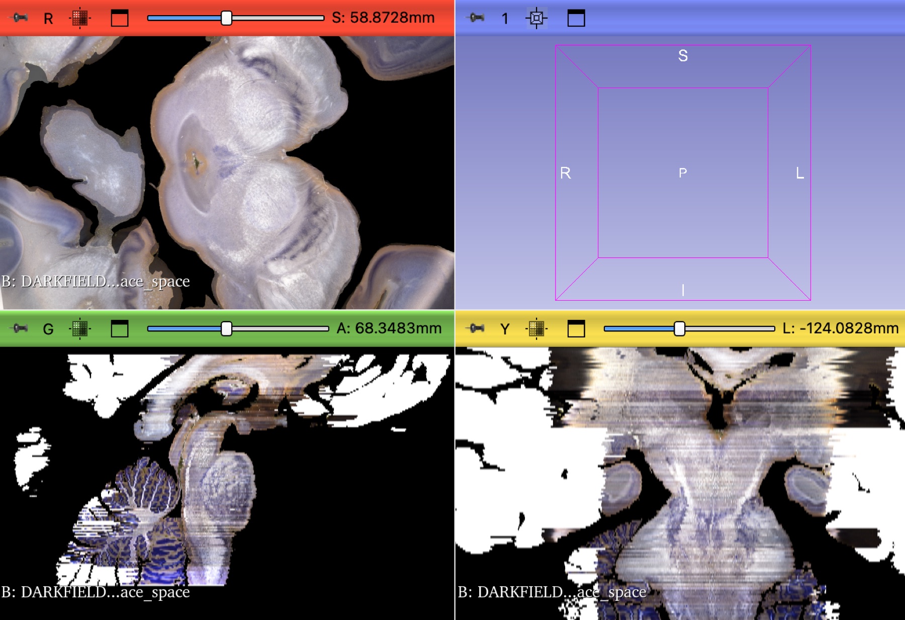Darkfield dataset shown in reconstructed orthogonal views