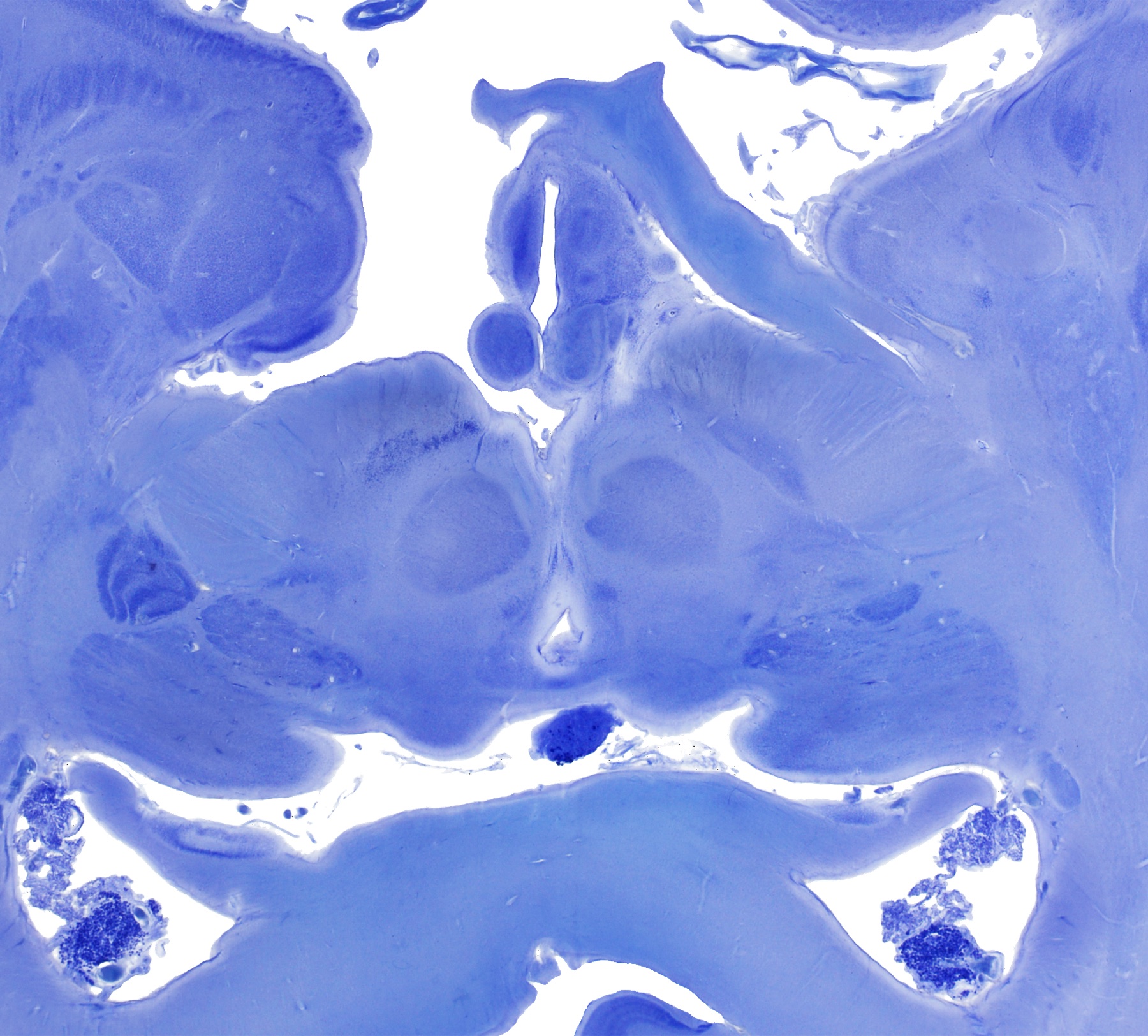 Brightfield histological section from the SWAN project