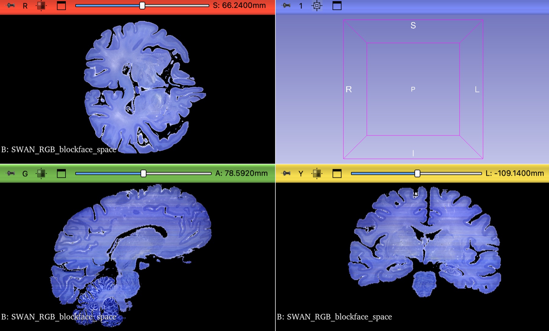 Histological dataset shown in reconstructed orthogonal views