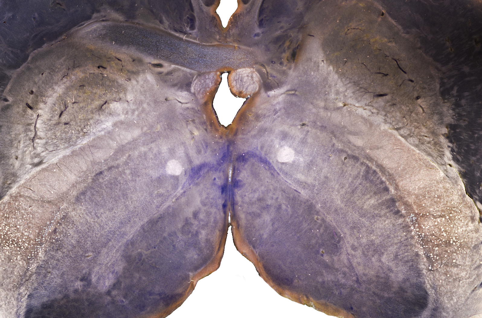 Darkfield microscopy detail from the SWAN project