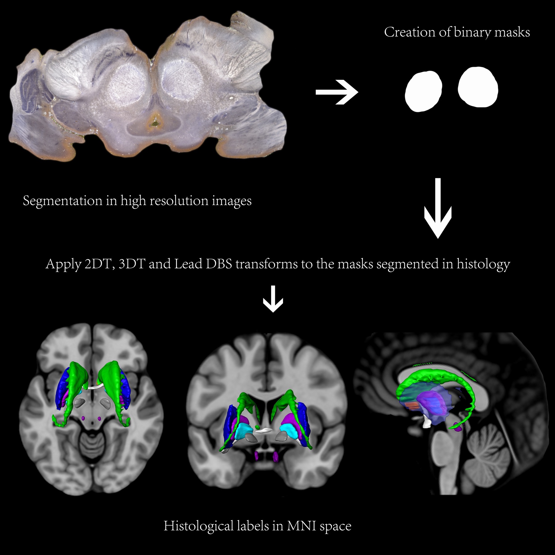 SWAN anatomical masks and multimodal processing figure