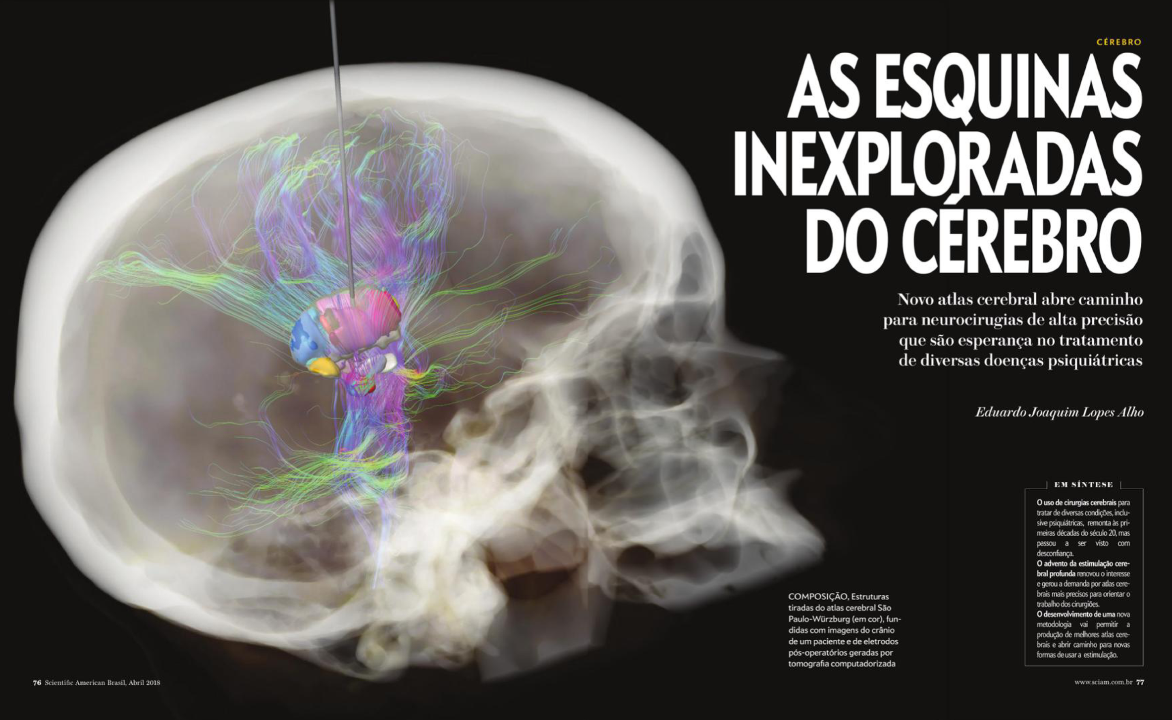 Scientific American Brasil article image featuring SWAN atlas work