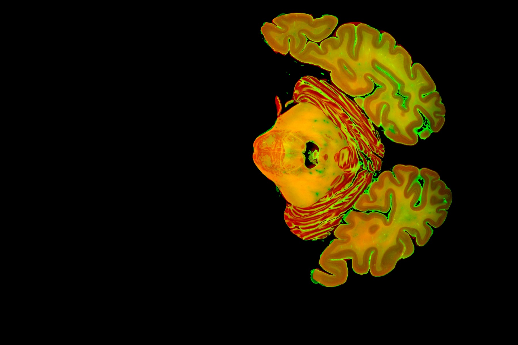 Brightfield histology-to-blockface registration example