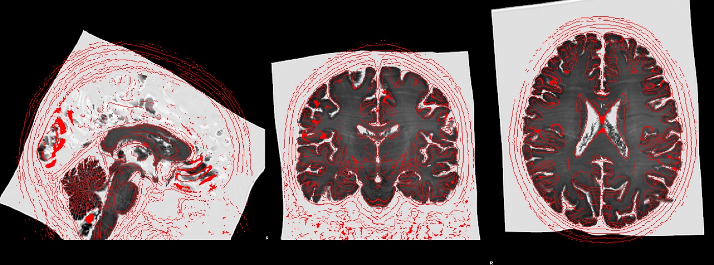 Brightfield histology transformed toward MNI space