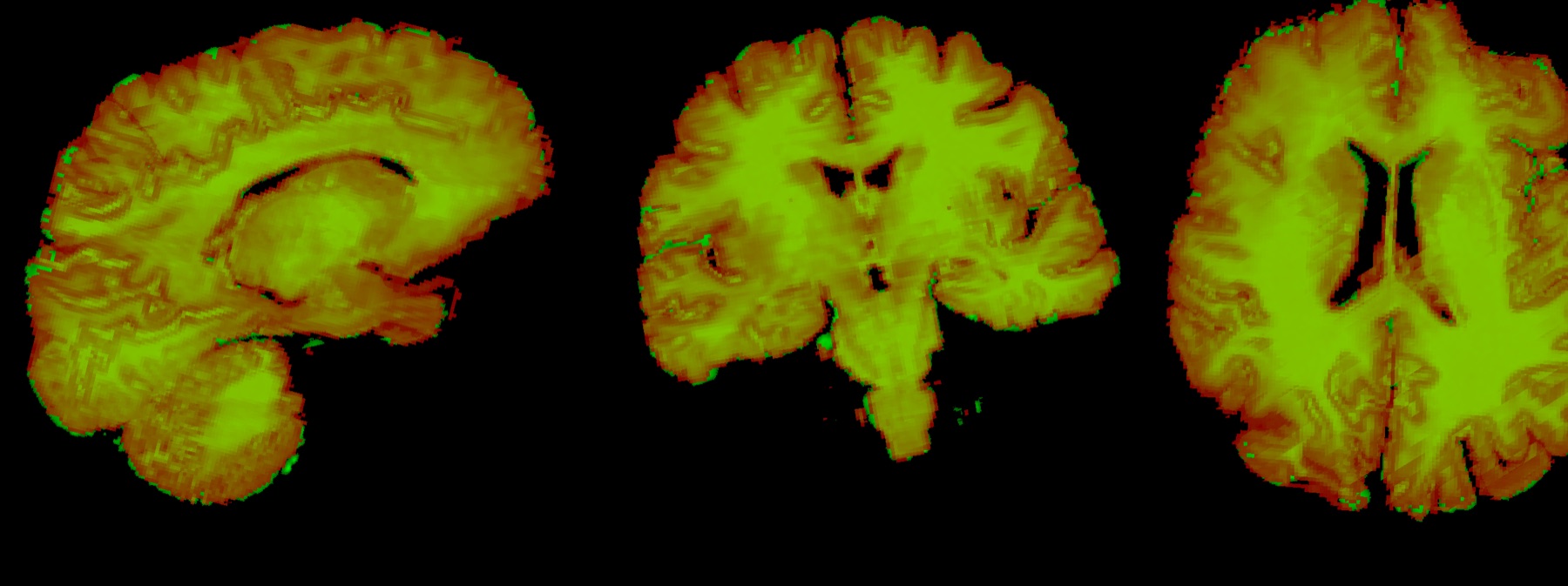 Brightfield histology-to-specimen MRI correspondence example
